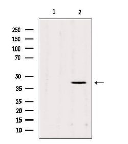 Invitrogen AGPAT3 Polyclonal Antibody 100 &mu;L; Unconjugated:Antibodies,