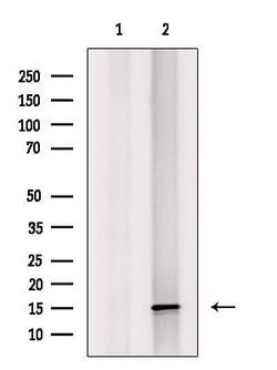 Invitrogen MRPS16 Polyclonal Antibody 100 &mu;L; Unconjugated:Antibodies,