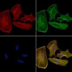 Invitrogen MRPS35 Polyclonal Antibody 100 &mu;L; Unconjugated:Antibodies,