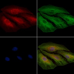 Invitrogen MRPS7 Polyclonal Antibody 100 &mu;L; Unconjugated:Antibodies,
