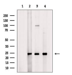 Invitrogen MRPS7 Polyclonal Antibody 100 &mu;L; Unconjugated:Antibodies,
