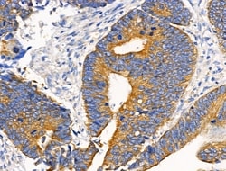 Invitrogen HSD3B7 Polyclonal Antibody 100 &mu;L; Unconjugated:Antibodies,