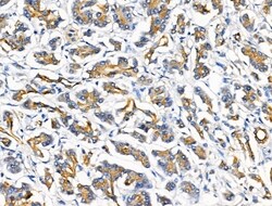 Invitrogen HSD3B7 Polyclonal Antibody 100 &mu;L; Unconjugated:Antibodies,