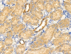 Invitrogen HSD3B7 Polyclonal Antibody 100 &mu;L; Unconjugated:Antibodies,