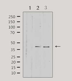 Invitrogen HSD3B7 Polyclonal Antibody 100 &mu;L; Unconjugated:Antibodies,