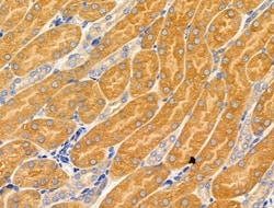 Invitrogen MRPL16 Polyclonal Antibody 100 &mu;L; Unconjugated:Antibodies,