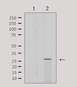 Invitrogen MRPL16 Polyclonal Antibody 100 &mu;L; Unconjugated:Antibodies,