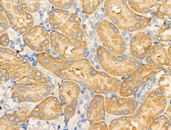 Invitrogen MRPL20 Polyclonal Antibody 100 &mu;L | Buy Online | Invitrogen&trade; | Fisher Scientific