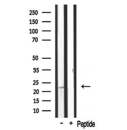 Invitrogen MRPL20 Polyclonal Antibody 100 &mu;L | Buy Online | Invitrogen&trade; | Fisher Scientific