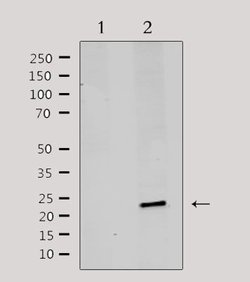 Invitrogen MRPL20 Polyclonal Antibody 100 &mu;L | Buy Online | Invitrogen&trade; | Fisher Scientific