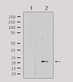 Invitrogen MRPL32 Polyclonal Antibody 100 &mu;L | Buy Online | Invitrogen&trade; | Fisher Scientific