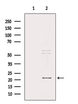 Invitrogen MRPL32 Polyclonal Antibody 100 &mu;L | Buy Online | Invitrogen&trade; | Fisher Scientific