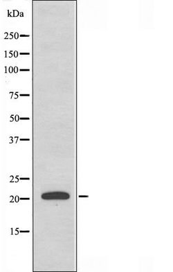 Invitrogen MRPL41 Polyclonal Antibody 100 &mu;L | Buy Online | Invitrogen&trade; | Fisher Scientific