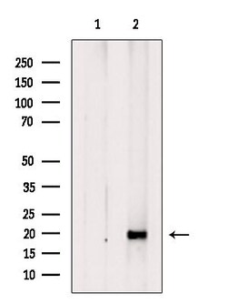 Invitrogen RPS11 Polyclonal Antibody 100 &mu;L; Unconjugated:Antibodies,