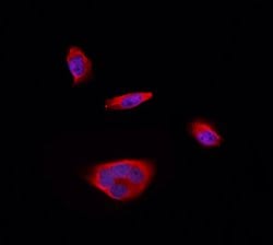 Invitrogen RPS12 Polyclonal Antibody 100 &mu;L; Unconjugated:Antibodies,