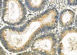 Invitrogen RPS12 Polyclonal Antibody 100 &mu;L; Unconjugated:Antibodies,