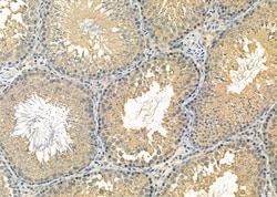 Invitrogen RPS12 Polyclonal Antibody 100 &mu;L; Unconjugated:Antibodies,