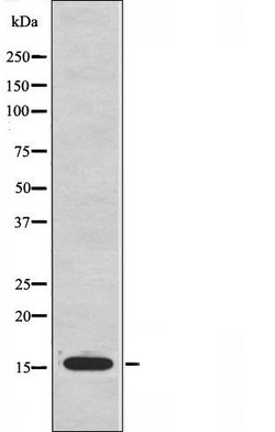 Invitrogen RPS12 Polyclonal Antibody 100 &mu;L; Unconjugated:Antibodies,