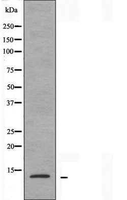 Invitrogen RPS20 Polyclonal Antibody 100 &mu;L; Unconjugated:Antibodies,