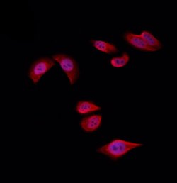 Invitrogen RPS4Y1 Polyclonal Antibody 100 &mu;L; Unconjugated:Antibodies,