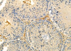 Invitrogen RPS4Y1 Polyclonal Antibody 100 &mu;L; Unconjugated:Antibodies,