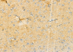 Invitrogen RPS4Y1 Polyclonal Antibody 100 &mu;L; Unconjugated:Antibodies,