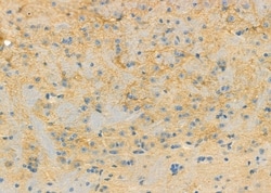 Invitrogen RPS4Y1 Polyclonal Antibody 100 &mu;L; Unconjugated:Antibodies,