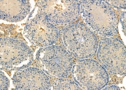 Invitrogen RPS4Y1 Polyclonal Antibody 100 &mu;L; Unconjugated:Antibodies,