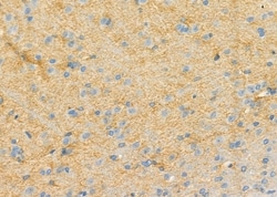Invitrogen RPS4Y1 Polyclonal Antibody 100 &mu;L; Unconjugated:Antibodies,