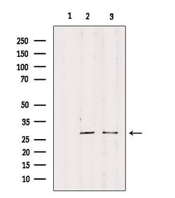 Invitrogen RPS4Y1 Polyclonal Antibody 100 &mu;L; Unconjugated:Antibodies,