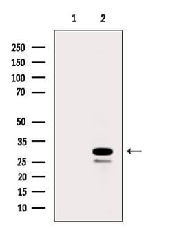 Invitrogen RPS8 Polyclonal Antibody 100 &mu;L | Buy Online | Invitrogen&trade; | Fisher Scientific