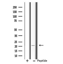 Invitrogen RPL11 Polyclonal Antibody 100 &mu;L; Unconjugated:Antibodies,