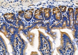 Invitrogen RPL18 Polyclonal Antibody 100 &mu;L; Unconjugated:Antibodies,