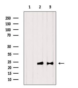 Invitrogen RPL18 Polyclonal Antibody 100 &mu;L; Unconjugated:Antibodies,