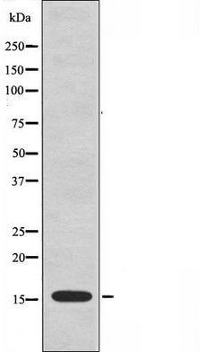 Invitrogen RPL23 Polyclonal Antibody 100 &mu;L; Unconjugated:Antibodies,