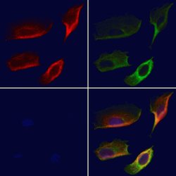 Invitrogen RPL28 Polyclonal Antibody 100 &mu;L; Unconjugated:Antibodies,