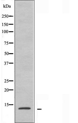 Invitrogen RPL30 Polyclonal Antibody 100 &mu;L | Buy Online | Invitrogen&trade; | Fisher Scientific