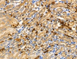 Invitrogen RPL36 Polyclonal Antibody 100 &mu;L; Unconjugated:Antibodies,