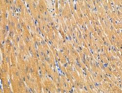 Invitrogen RPL36 Polyclonal Antibody 100 &mu;L; Unconjugated:Antibodies,