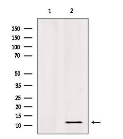 Invitrogen RPL36 Polyclonal Antibody 100 &mu;L; Unconjugated:Antibodies,