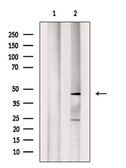 Invitrogen ABHD12 Polyclonal Antibody 100 &mu;L | Buy Online | Invitrogen&trade; | Fisher Scientific