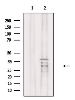 Invitrogen ABHD14A Polyclonal Antibody 100 &mu;L; Unconjugated:Antibodies,