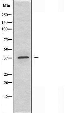 Invitrogen ABHD9 Polyclonal Antibody 100 &mu;L | Buy Online | Invitrogen&trade; | Fisher Scientific