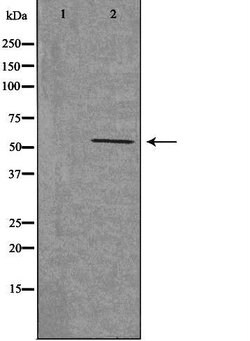 Invitrogen CHRNB1 Polyclonal Antibody 100 &mu;L; Unconjugated:Antibodies,