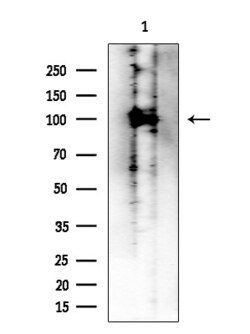 Invitrogen ACSS1 Polyclonal Antibody 100 &mu;L; Unconjugated:Antibodies,