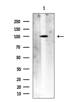 Invitrogen ACSS1 Polyclonal Antibody 100 &mu;L; Unconjugated:Antibodies,
