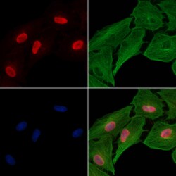 Invitrogen PHAPI2 Polyclonal Antibody 100 &mu;L; Unconjugated:Antibodies,