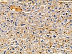 Invitrogen ACOT1 Polyclonal Antibody 100 &mu;L | Buy Online | Invitrogen&trade; | Fisher Scientific