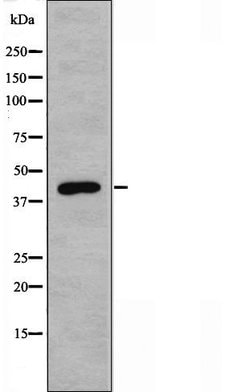 Invitrogen ACOT1 Polyclonal Antibody 100 &mu;L | Buy Online | Invitrogen&trade; | Fisher Scientific