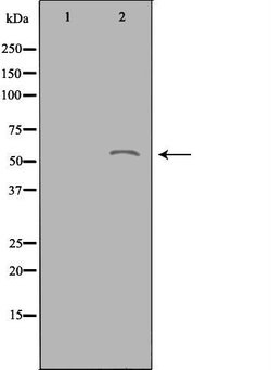 Invitrogen ACOT2 Polyclonal Antibody 100 &mu;L; Unconjugated:Antibodies,